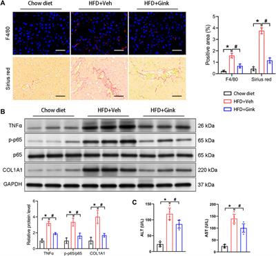 Beneficial effects of ginkgetin on improving nonalcoholic steatohepatitis characterized by bulk and single-cell RNA sequencing analysis